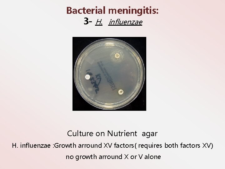 Bacterial meningitis: 3 - H. influenzae Culture on Nutrient agar H. influenzae : Growth