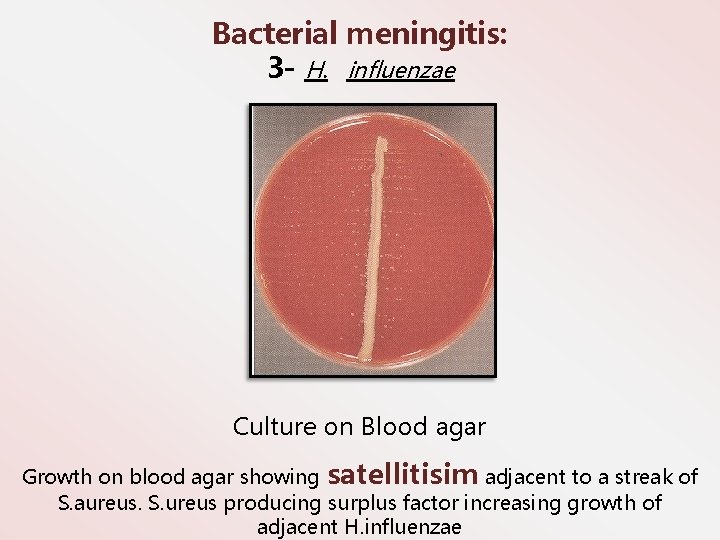 Bacterial meningitis: 3 - H. influenzae Culture on Blood agar Growth on blood agar