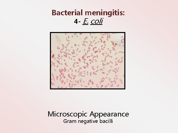 Bacterial meningitis: 4 - E. coli Microscopic Appearance Gram negative bacilli 