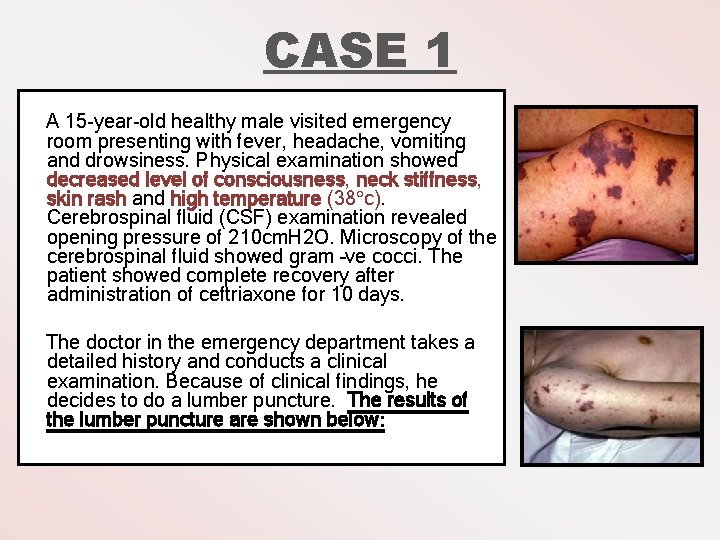 CASE 1 A 15 -year-old healthy male visited emergency room presenting with fever, headache,