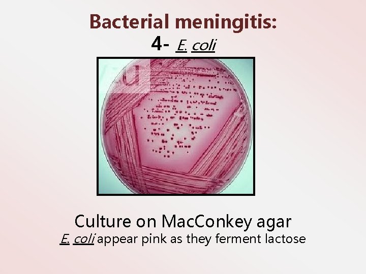 Bacterial meningitis: 4 - E. coli Culture on Mac. Conkey agar E. coli appear