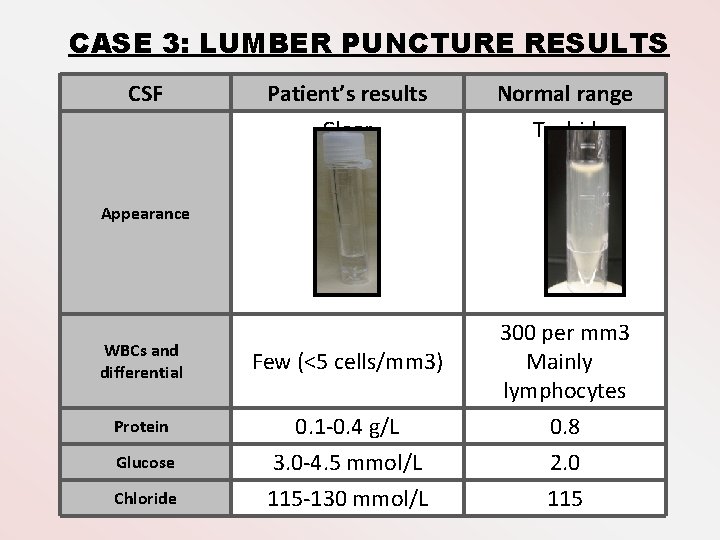 CASE 3: LUMBER PUNCTURE RESULTS CSF Patient’s results Normal range Clear Turbid WBCs and