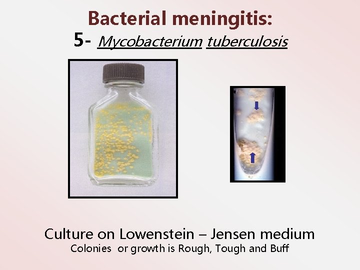 Bacterial meningitis: 5 - Mycobacterium tuberculosis Culture on Lowenstein – Jensen medium Colonies or