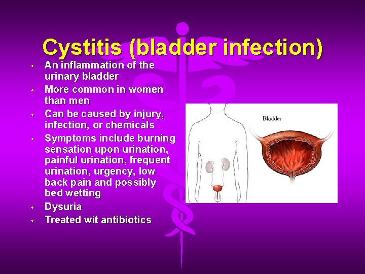 Cystitis (bladder infection) • • • An inflammation of the urinary bladder More common