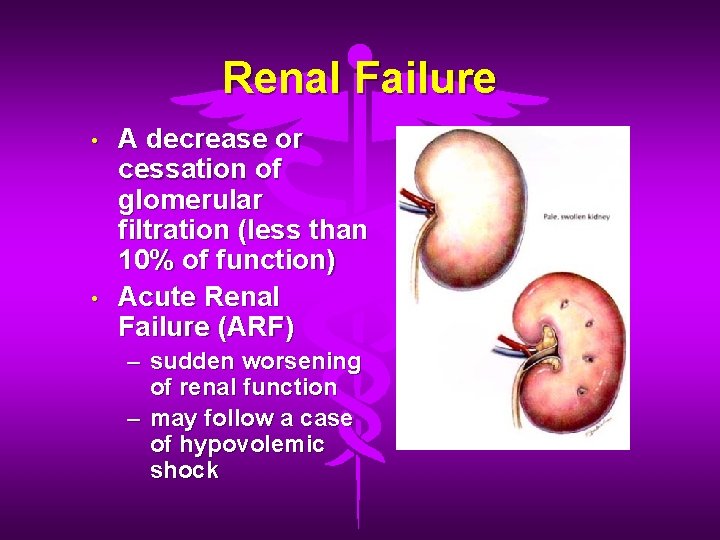 Renal Failure • • A decrease or cessation of glomerular filtration (less than 10%