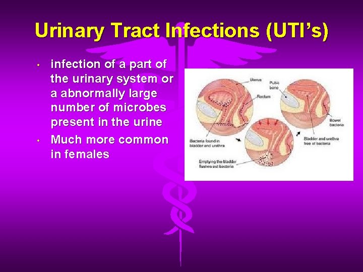 Urinary Tract Infections (UTI’s) • • infection of a part of the urinary system