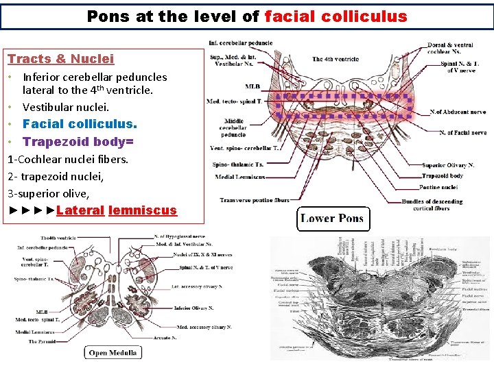 Pons at the level of facial colliculus Tracts & Nuclei • Inferior cerebellar peduncles