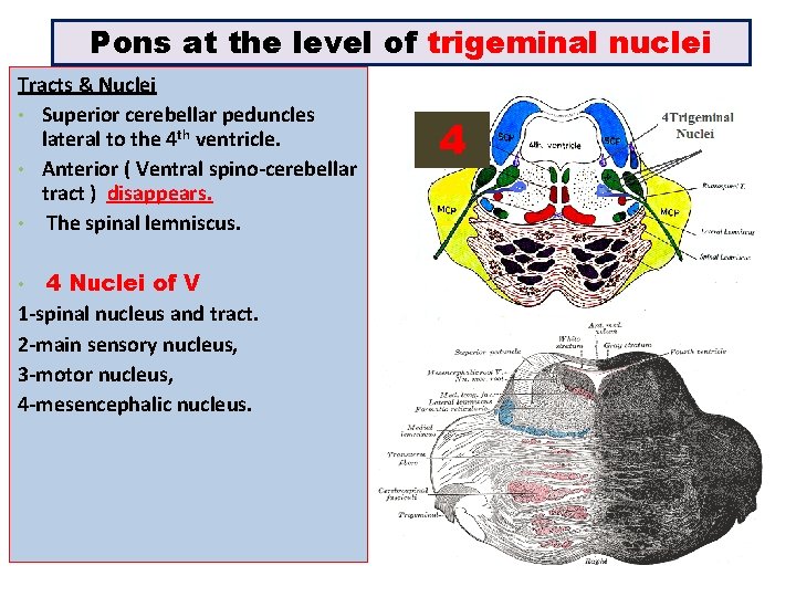 Pons at the level of trigeminal nuclei Tracts & Nuclei • Superior cerebellar peduncles