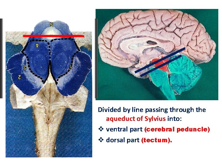 Divided by line passing through the aqueduct of Sylvius into: v ventral part (cerebral