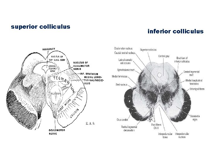 superior colliculus inferior colliculus 