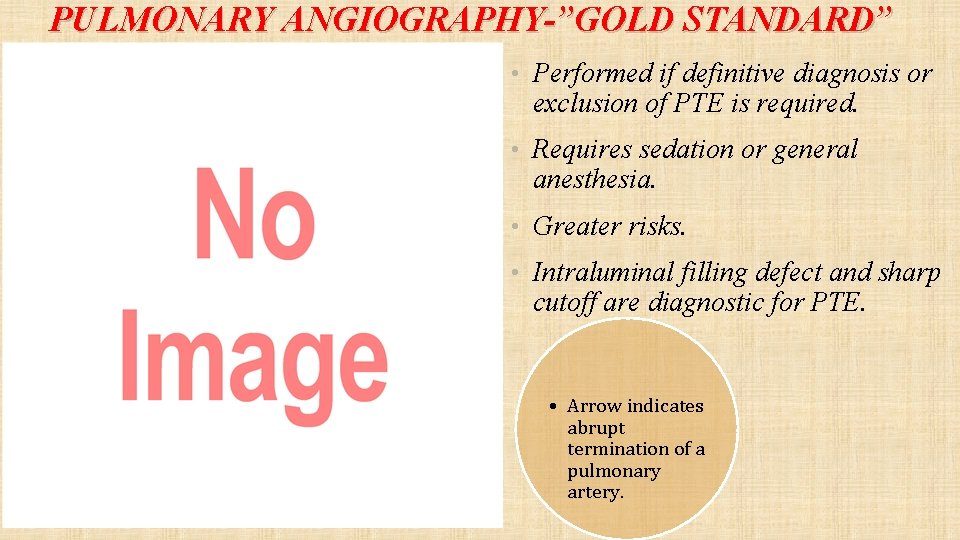 PULMONARY ANGIOGRAPHY-”GOLD STANDARD” • Performed if definitive diagnosis or exclusion of PTE is required.