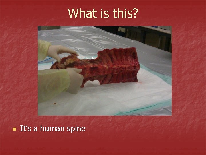 What is this? n It’s a human spine 