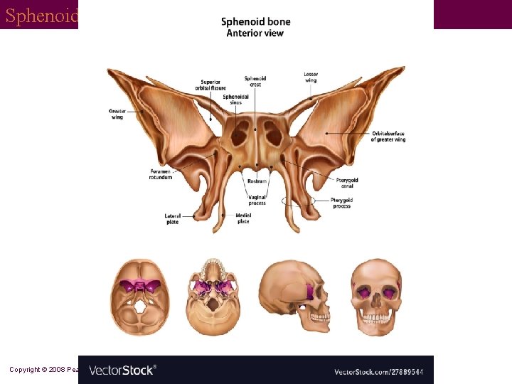 Sphenoid Copyright © 2008 Pearson Education, Inc. , publishing as Benjamin Cummings 
