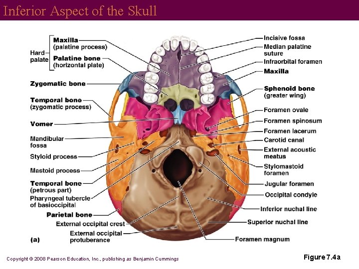 Inferior Aspect of the Skull Copyright © 2008 Pearson Education, Inc. , publishing as