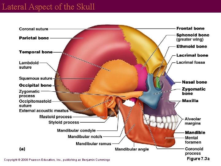 Lateral Aspect of the Skull Copyright © 2008 Pearson Education, Inc. , publishing as