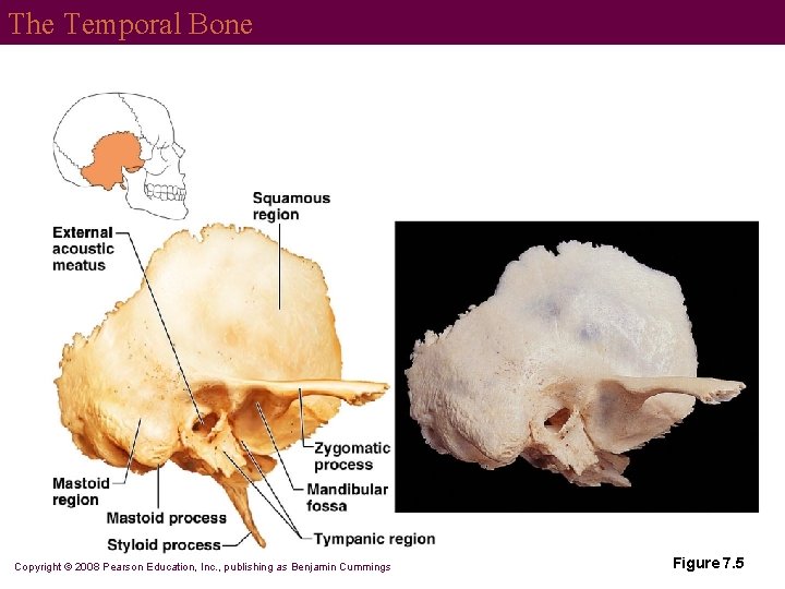 The Temporal Bone Copyright © 2008 Pearson Education, Inc. , publishing as Benjamin Cummings