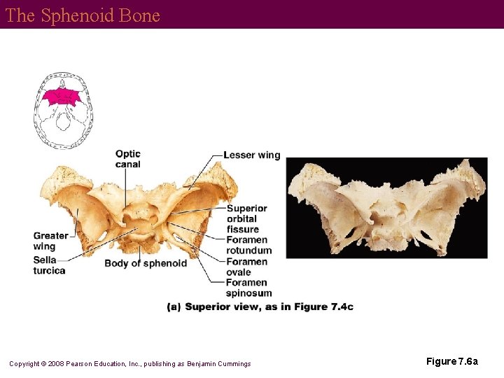 The Sphenoid Bone Copyright © 2008 Pearson Education, Inc. , publishing as Benjamin Cummings