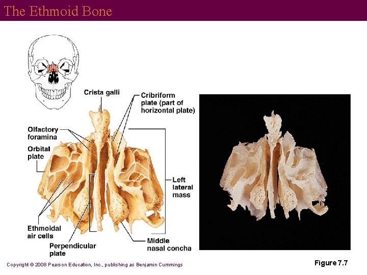 The Ethmoid Bone Copyright © 2008 Pearson Education, Inc. , publishing as Benjamin Cummings