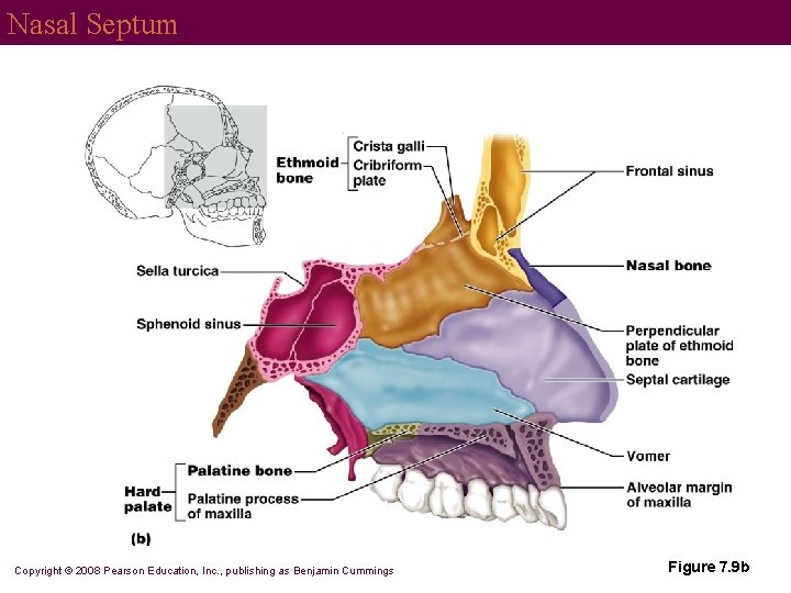 Nasal Septum Copyright © 2008 Pearson Education, Inc. , publishing as Benjamin Cummings Figure