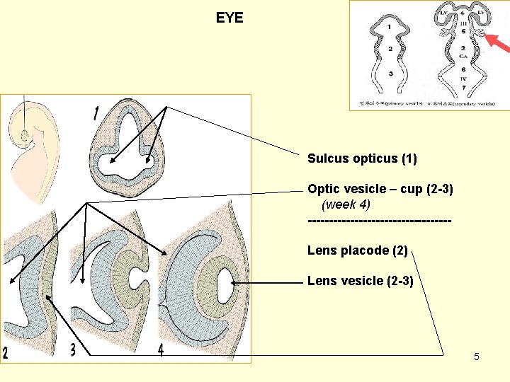 EYE Sulcus opticus (1) Optic vesicle – cup (2 -3) (week 4) -----------------Lens placode