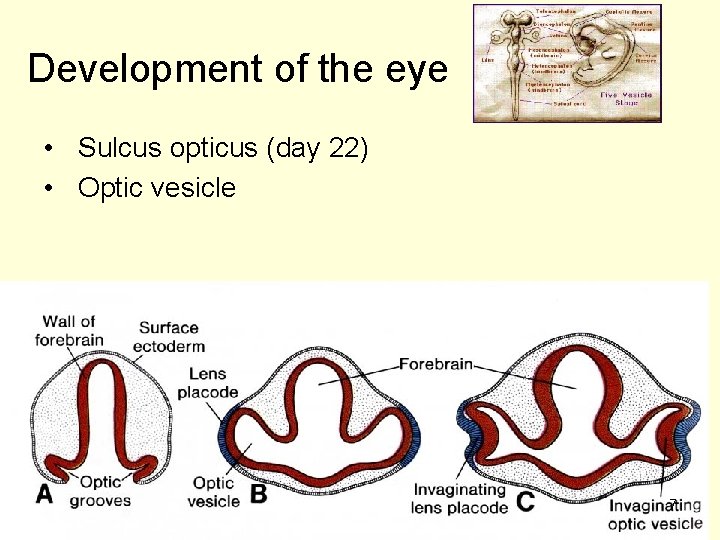 Development of the eye • Sulcus opticus (day 22) • Optic vesicle 7 