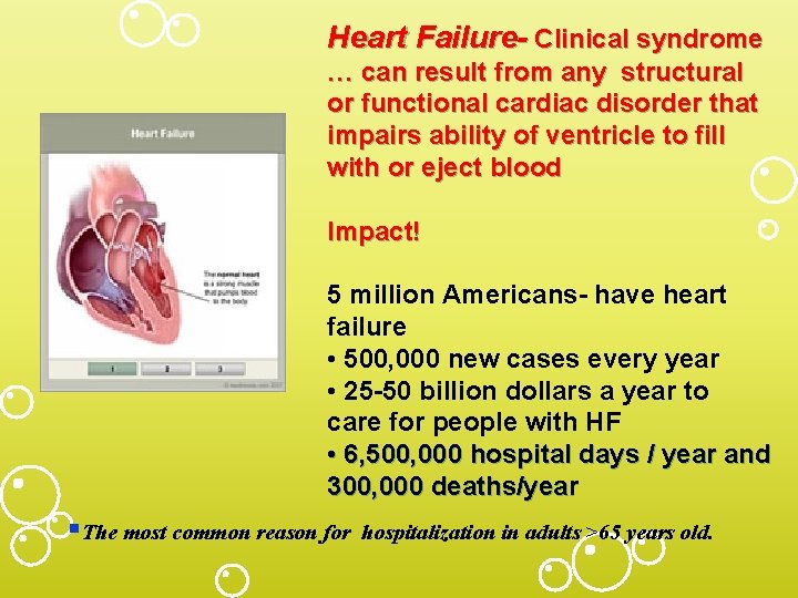 Heart Failure- Clinical syndrome … can result from any structural or functional cardiac disorder