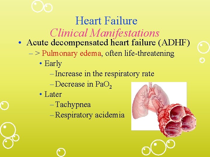 Heart Failure Clinical Manifestations • Acute decompensated heart failure (ADHF) – > Pulmonary edema,