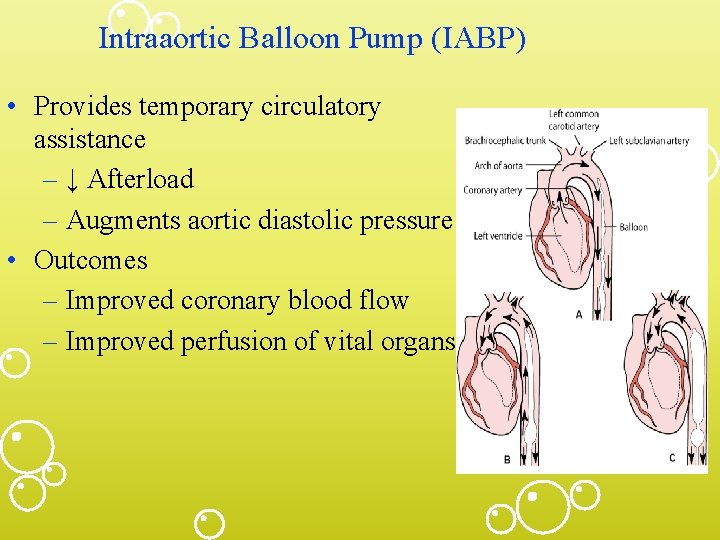 Intraaortic Balloon Pump (IABP) • Provides temporary circulatory assistance – ↓ Afterload – Augments