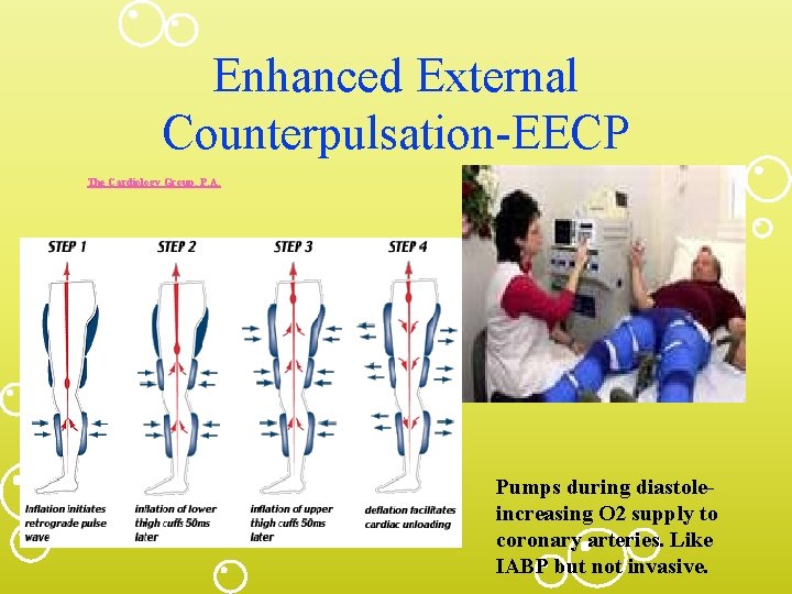 Enhanced External Counterpulsation-EECP The Cardiology Group, P. A. Pumps during diastoleincreasing O 2 supply