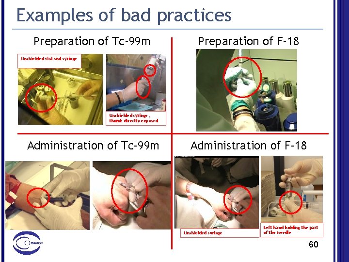 Examples of bad practices Preparation of Tc-99 m Preparation of F-18 Unshielded vial and