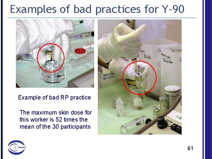 Examples of bad practices for Y-90 Example of bad RP practice The maximum skin