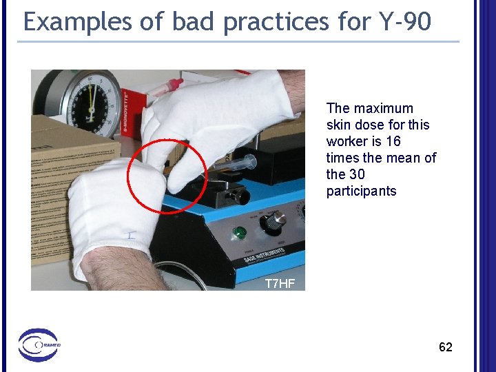 Examples of bad practices for Y-90 The maximum skin dose for this worker is