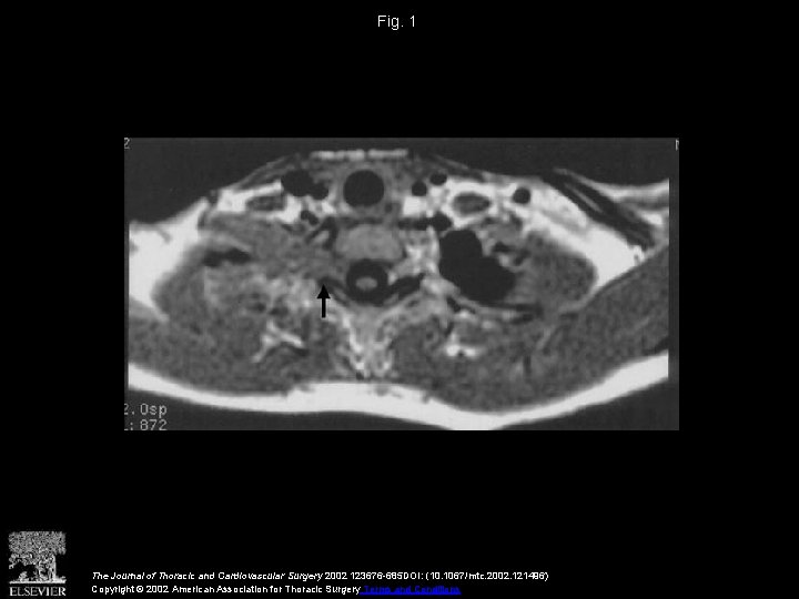 Fig. 1 The Journal of Thoracic and Cardiovascular Surgery 2002 123676 -685 DOI: (10.