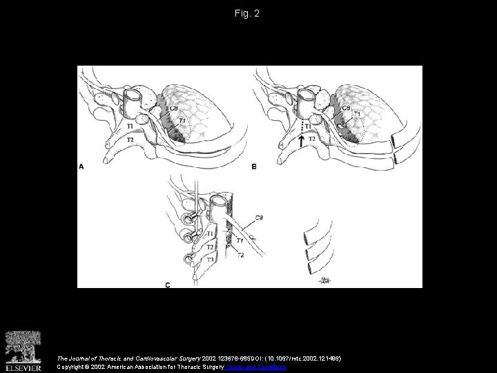 Fig. 2 The Journal of Thoracic and Cardiovascular Surgery 2002 123676 -685 DOI: (10.