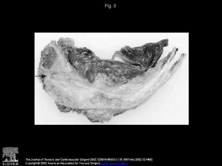 Fig. 3 The Journal of Thoracic and Cardiovascular Surgery 2002 123676 -685 DOI: (10.