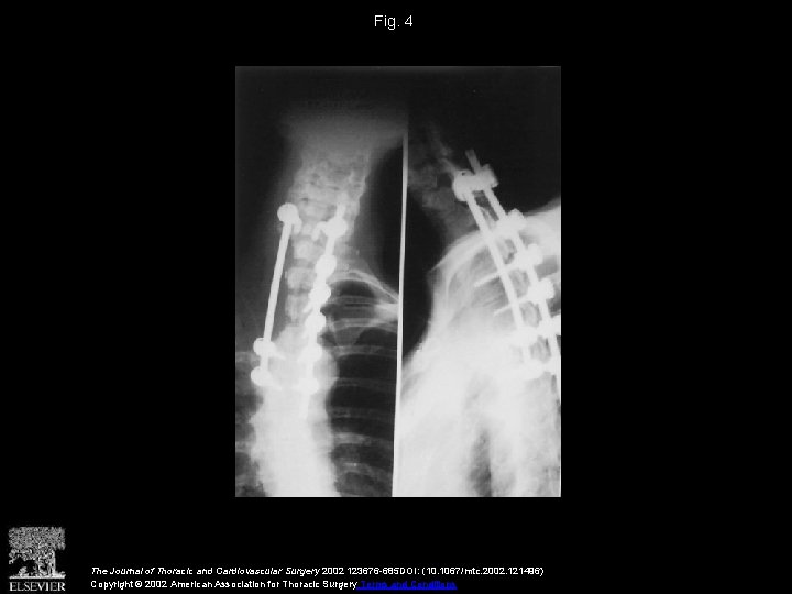 Fig. 4 The Journal of Thoracic and Cardiovascular Surgery 2002 123676 -685 DOI: (10.