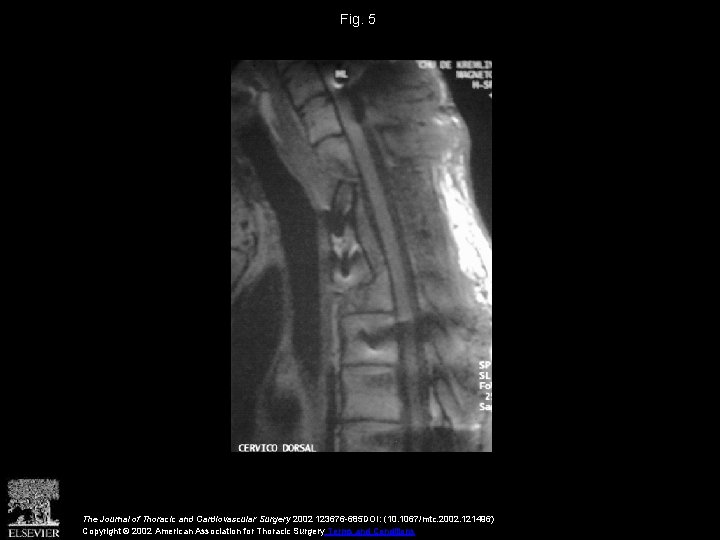 Fig. 5 The Journal of Thoracic and Cardiovascular Surgery 2002 123676 -685 DOI: (10.