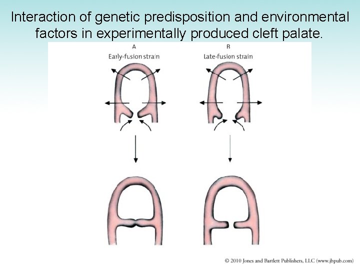 Interaction of genetic predisposition and environmental factors in experimentally produced cleft palate. 
