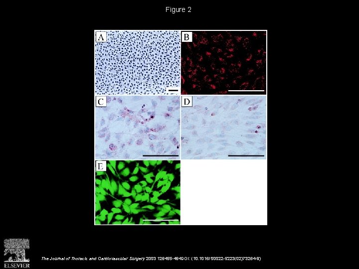 Figure 2 The Journal of Thoracic and Cardiovascular Surgery 2003 126455 -464 DOI: (10.