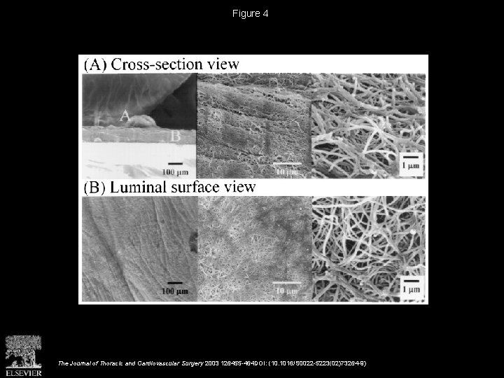 Figure 4 The Journal of Thoracic and Cardiovascular Surgery 2003 126455 -464 DOI: (10.