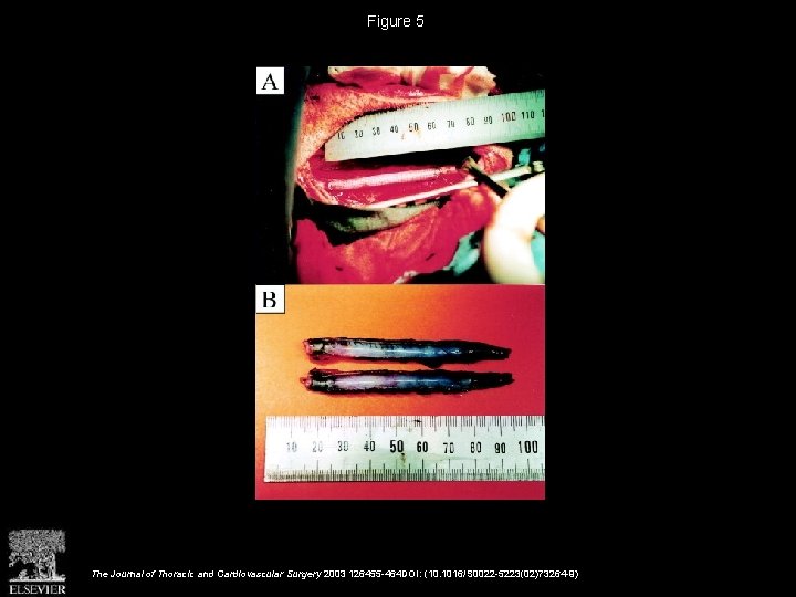 Figure 5 The Journal of Thoracic and Cardiovascular Surgery 2003 126455 -464 DOI: (10.