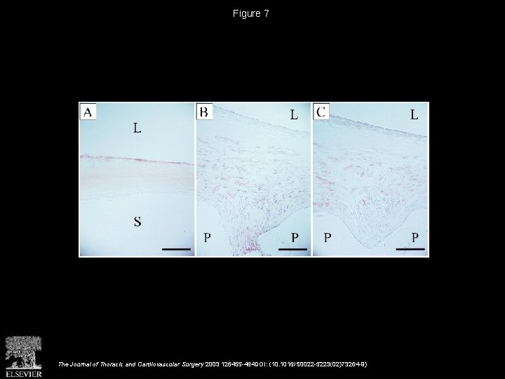 Figure 7 The Journal of Thoracic and Cardiovascular Surgery 2003 126455 -464 DOI: (10.