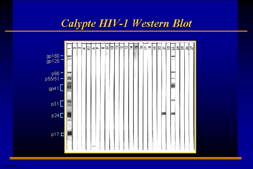 Calypte HIV-1 Western Blot gp 160 gp 120 p 66 p 55/51 gp 41