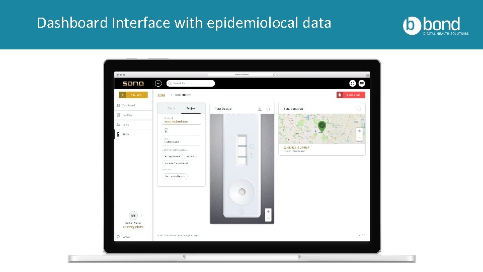 Dashboard Interface with epidemiolocal data 