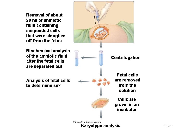 Removal of about 20 ml of amniotic ﬂuid containing suspended cells that were sloughed