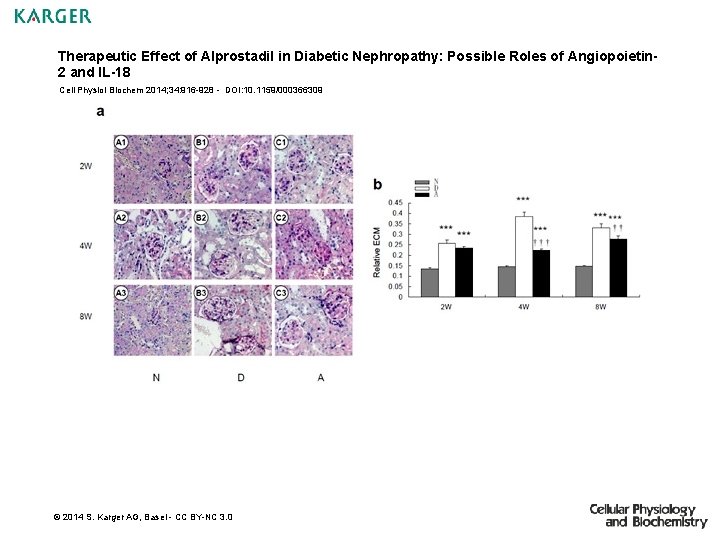 Therapeutic Effect of Alprostadil in Diabetic Nephropathy: Possible Roles of Angiopoietin 2 and IL-18