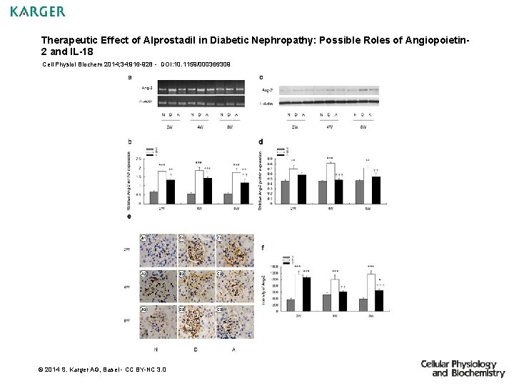 Therapeutic Effect of Alprostadil in Diabetic Nephropathy: Possible Roles of Angiopoietin 2 and IL-18