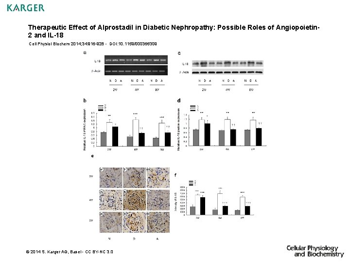 Therapeutic Effect of Alprostadil in Diabetic Nephropathy: Possible Roles of Angiopoietin 2 and IL-18