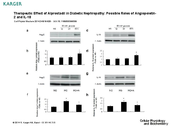 Therapeutic Effect of Alprostadil in Diabetic Nephropathy: Possible Roles of Angiopoietin 2 and IL-18