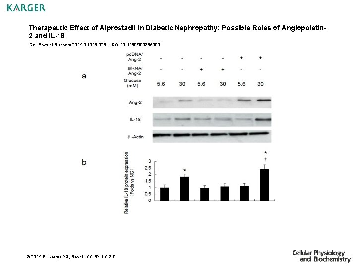 Therapeutic Effect of Alprostadil in Diabetic Nephropathy: Possible Roles of Angiopoietin 2 and IL-18